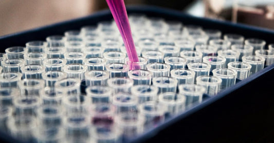 Immunodiagnostics Market Projected to Reach USD 27 Billion by 2030, Driven by Advancements in Diagnostic Technologies