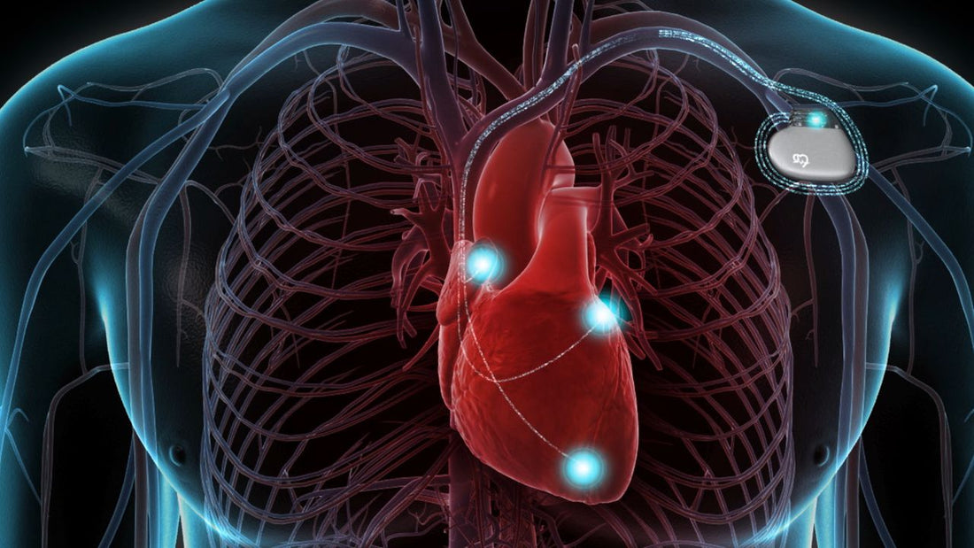 Implantable Defibrillators Market Expected to Reach USD 12 Billion by 2030