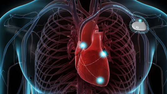 Implantable Defibrillators Market Expected to Reach USD 12 Billion by 2030