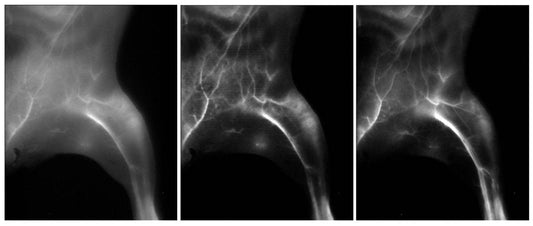 Near Infrared Imaging Market Set for Steady Growth, Projected to Reach $435 Million by 2030