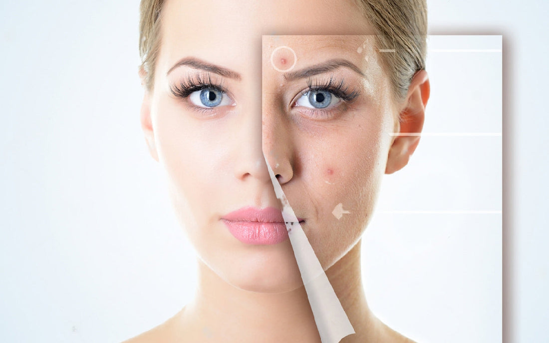 The Growing Market for Acne Medication: Clinically Proven Solutions and Investment Potential