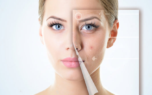 The Growing Market for Acne Medication: Clinically Proven Solutions and Investment Potential