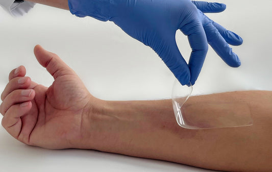 How Do Hydrogel Dressings Revolutionize Wound Care?