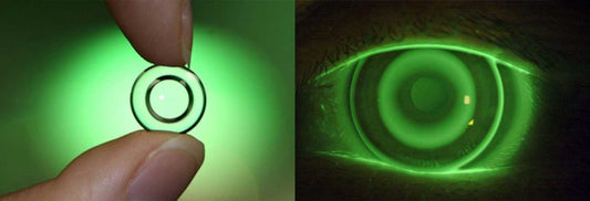 Orthokeratology Lens Market to Hit USD 973 Million by 2030, Fueled by Myopia Management and Technological Advancements