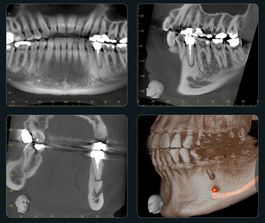 Finland Cone-Beam Computed Tomography (CBCT) Systems Market is Predicted to Reach USD 10 Million with a CAGR of 17% by 2030