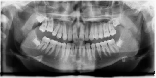 The Canada Cone-Beam Computed Tomography (CBCT) Systems Market is Predicted to Reach USD 75 Million with a CAGR of 10% by 2030