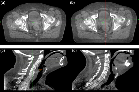 The Middle East Cone-Beam Computed Tomography (CBCT) Systems Market is Predicted to Reach USD 74 Million with a CAGR of 13% by 2030