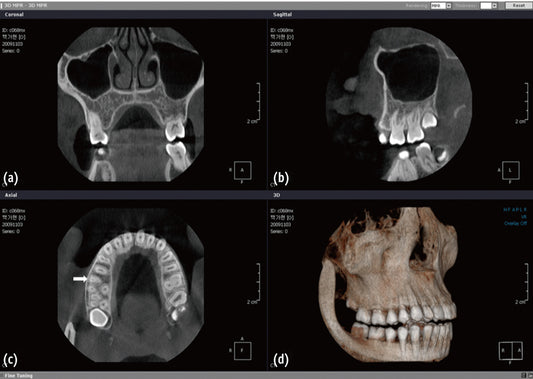 The Mexico Cone-Beam Computed Tomography (CBCT) Systems Market is Predicted to Reach USD 207 Million with a CAGR of 13% by 2030