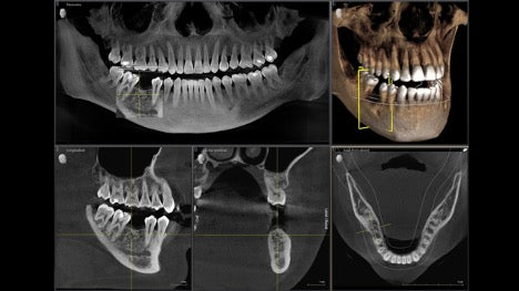 Sweden Cone-Beam Computed Tomography (CBCT) Systems Market is Predicted to Reach USD 21 Million with a CAGR of 10% by 2030