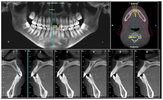 South Korea Cone-Beam Computed Tomography (CBCT) Systems Market is Predicted to Reach USD 92 Million with a CAGR of 16% by 2030