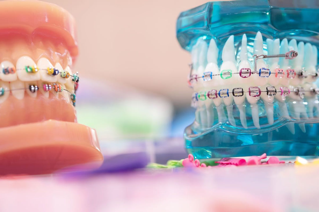 Orthodontics Market Set to Reach USD 4 Billion by 2030, Fueled by Technological Advancements and Rising Demand for Aesthetic Solutions