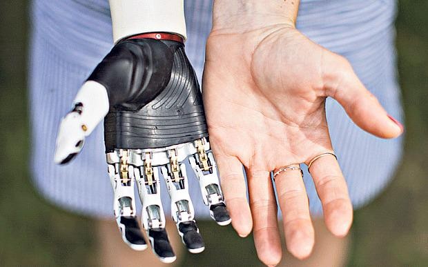Vital Organs Support Systems and Medical Bionics Market Projected to Reach USD 94 Billion by 2030, Driven by Technological Advancements and Growing Demand