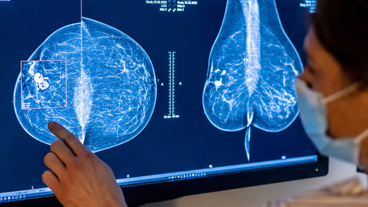 Mammography Market to Reach USD 4 Billion by 2030, Growing at a CAGR of 9% from 2023 to 2030