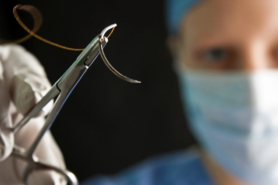 Suture Needles Market Set to Reach USD 758 Million by 2030, Driven by Growing Demand for Surgical Procedures and Technological Advancements