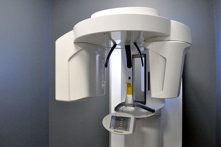Cone-Beam Computed Tomography (CBCT) Systems Market Set to Reach USD 3 Billion by 2030, Fueled by Increasing Demand in Dentistry and Medical Applications