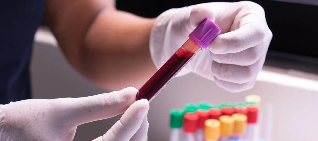 Blood Preparation Market to Reach USD 73 Billion by 2030, Growing at a CAGR of 6%
