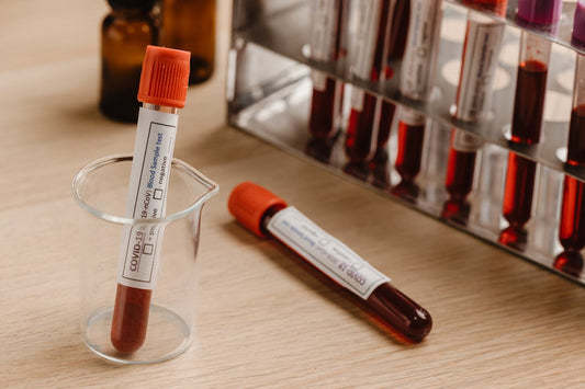 Blood Collection Tubes Market Size Predicted to Reach $3 Billion with a 6% CAGR by 2030