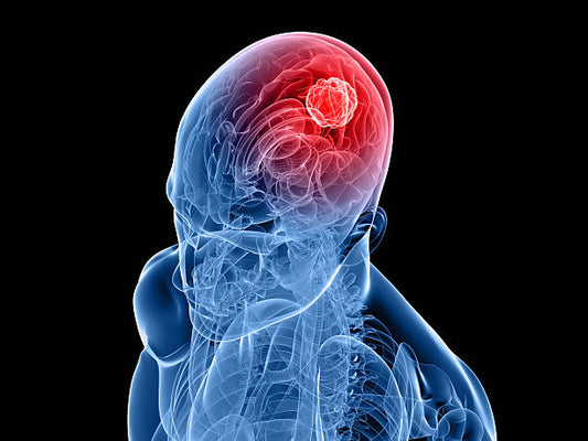 Brain Tumor Diagnosis & Therapeutics Market to Reach USD 1,107 Million by 2030, Growing at a CAGR of 8%
