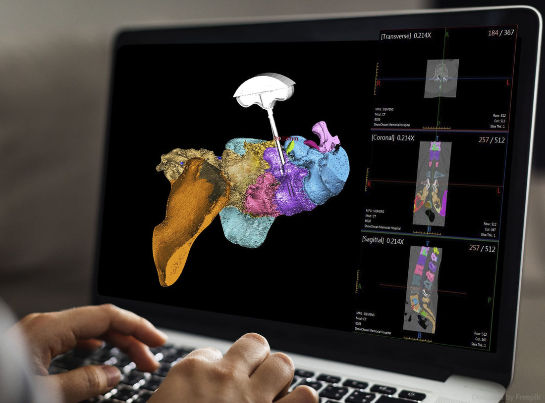 Surge in Orthopedic Surgery Demand Drives Growth in Preoperative Surgical Planning Software Market