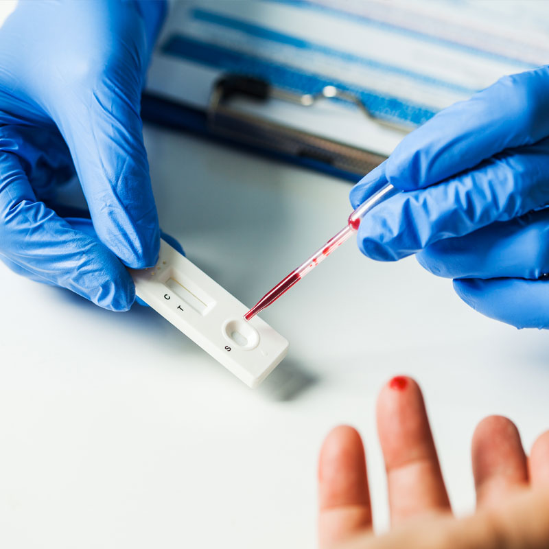 In-Vitro Diagnostic (IVD) Market Set to Reach USD 119 Billion by 2030, Driven by Technological Advancements and Rising Chronic Disease Incidence