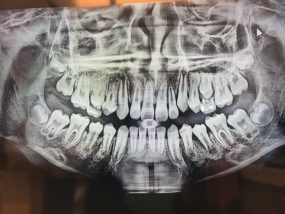 Dental Imaging Market to Reach USD 7 Billion by 2030, Growing at a 9% CAGR