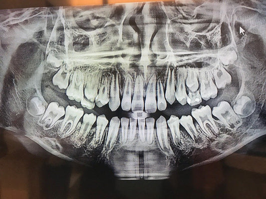 Dental Imaging Market to Reach USD 7 Billion by 2030, Growing at a 9% CAGR