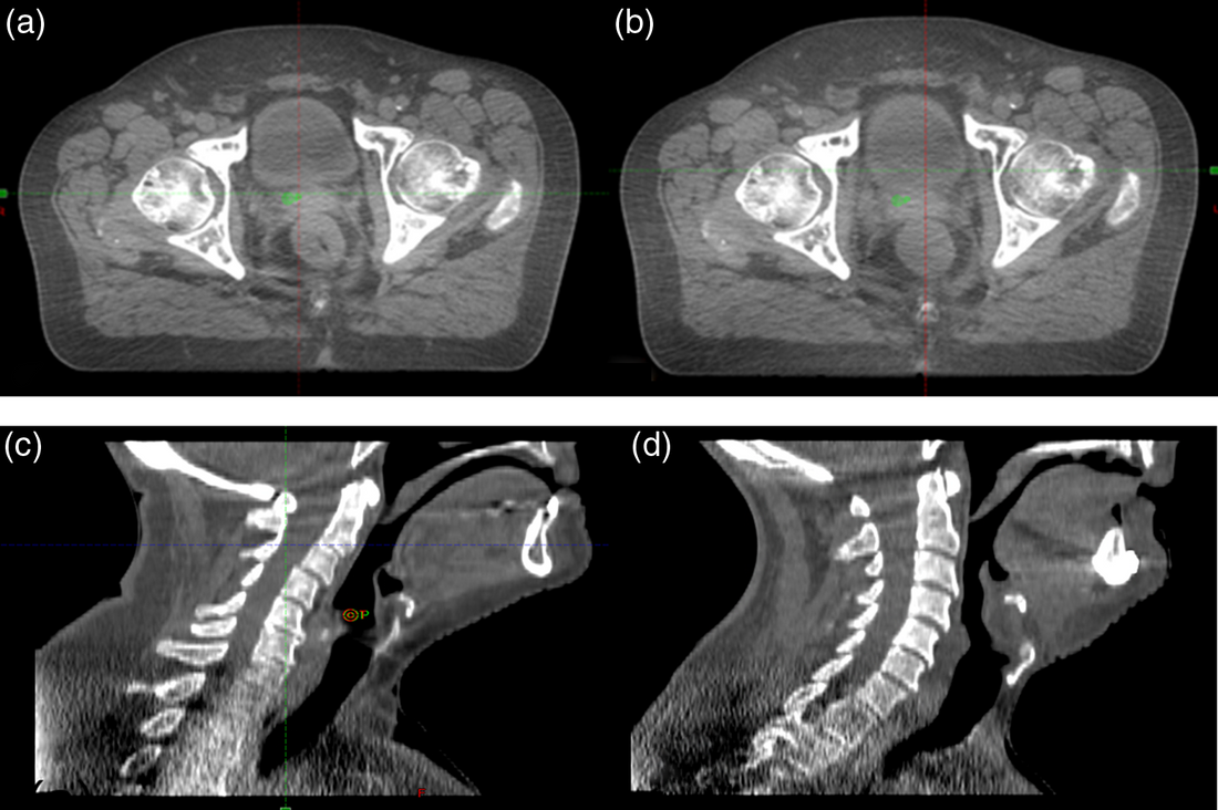 The Middle East Cone-Beam Computed Tomography (CBCT) Systems Market is Predicted to Reach USD 74 Million with a CAGR of 13% by 2030
