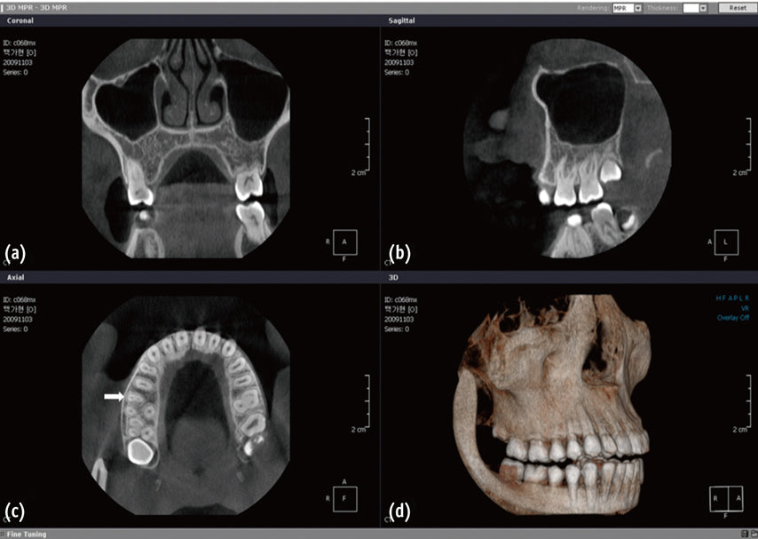 The Mexico Cone-Beam Computed Tomography (CBCT) Systems Market is Predicted to Reach USD 207 Million with a CAGR of 13% by 2030