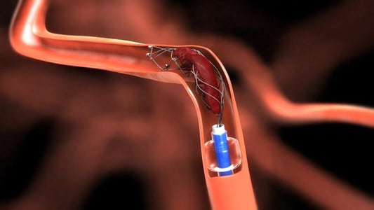 Neurovascular Device Market Poised for Significant Growth, Expected to Reach USD 6 Billion by 2030