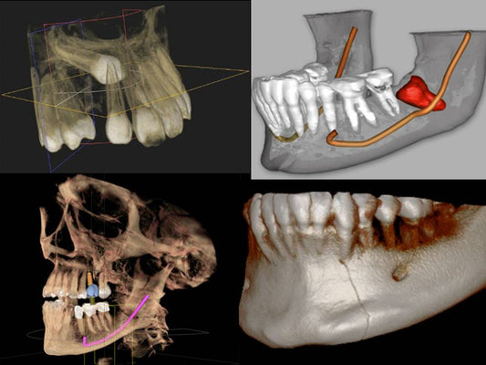 The UK Cone-Beam Computed Tomography (CBCT) Systems Market is Predicted to Reach USD 46 Million with a CAGR of 4% by 2030