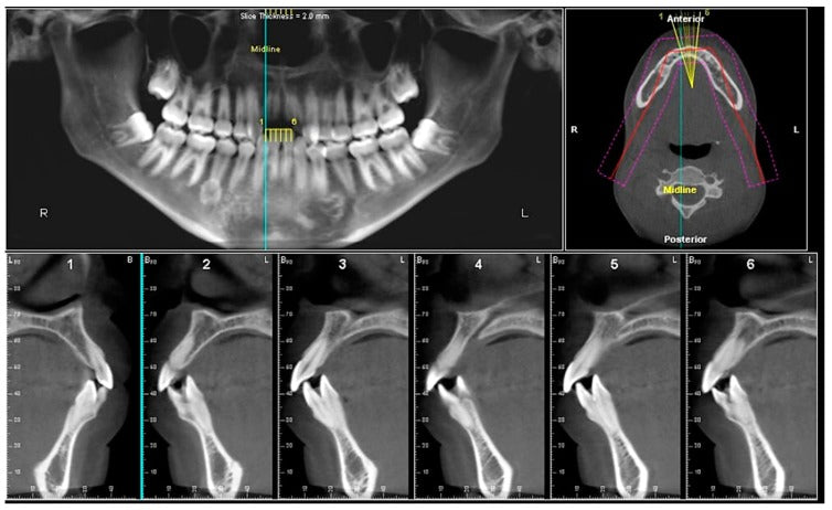 South Korea Cone-Beam Computed Tomography (CBCT) Systems Market is Predicted to Reach USD 92 Million with a CAGR of 16% by 2030