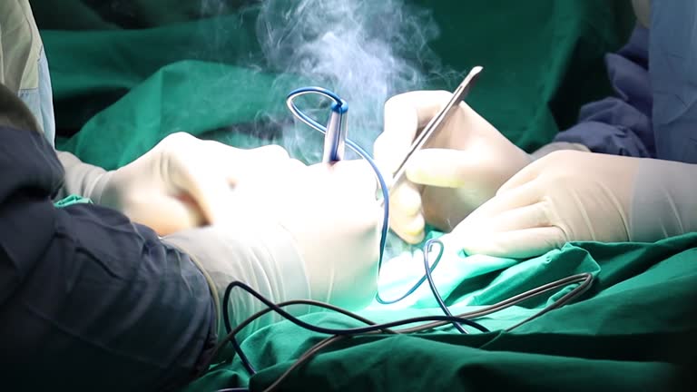 Smoke Evacuation System Market to Reach USD 367 Million by 2030, Driven by Surgical Procedure Growth and Healthcare Advancements