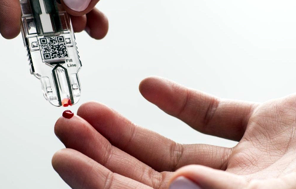 Care Diagnostics Market Set to Expand as Demand for Home Healthcare and Preventative Testing Increases