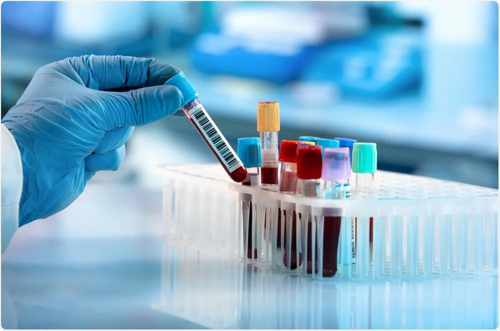 Growth and Challenges in the America In-Vitro Diagnostics Market: An In-Depth Analysis