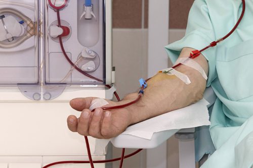 Mexico Dialysis Market Set for Strong Growth, Expected to Reach USD 2 Billion by 2030
